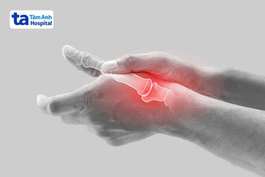 triệu chứng khi bị tràn dịch khớp ngón tay