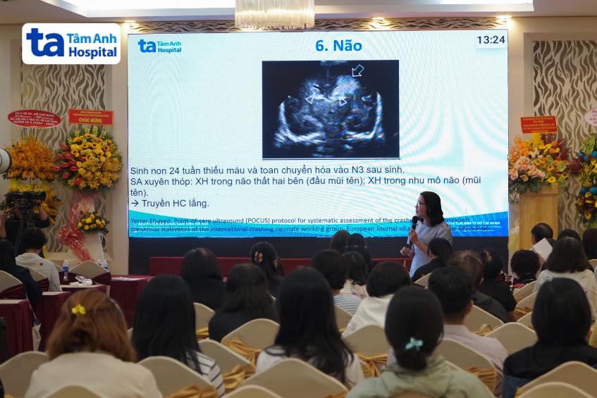 TS BS Cam Ngọc Phượng chia sẻ kỹ thuật POCUS