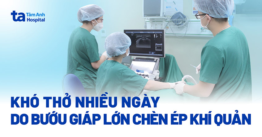 Tưởng u trung thất hóa bướu giáp to thòng xuống ngực