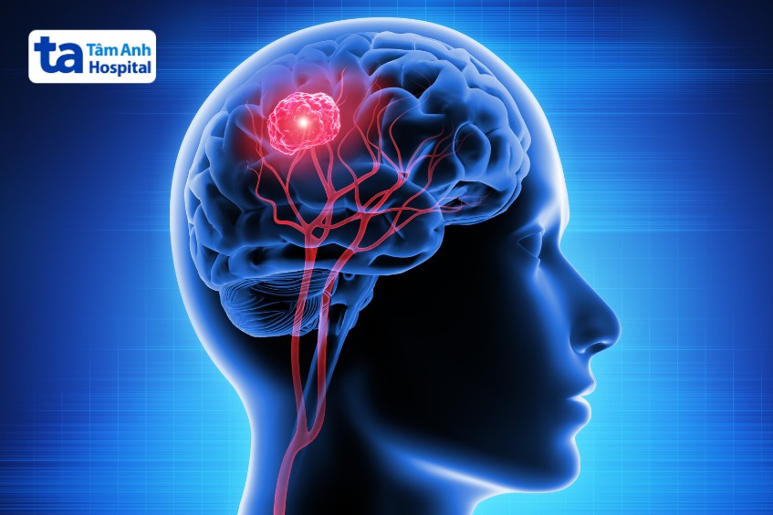 u não được chỉ định mổ não bằng robot