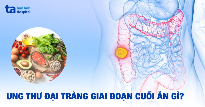 Ung thư đại tràng giai đoạn cuối nên ăn gì để đảm bảo sức khỏe?