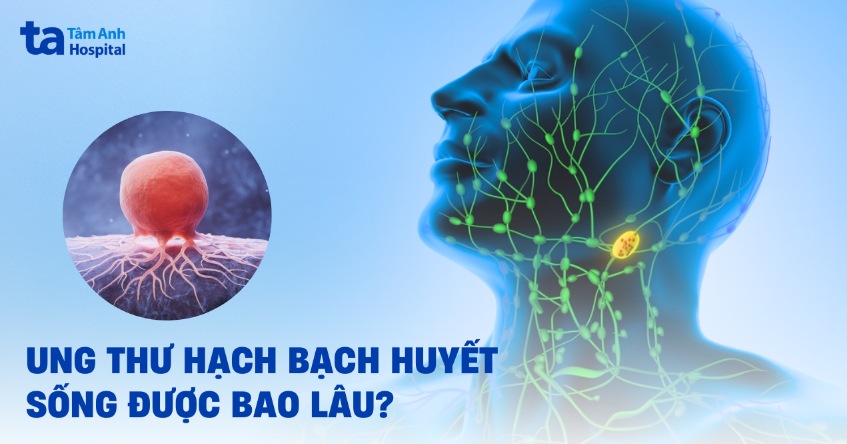 Ung thư hạch bạch huyết sống được bao lâu? Tiên lượng từng giai đoạn