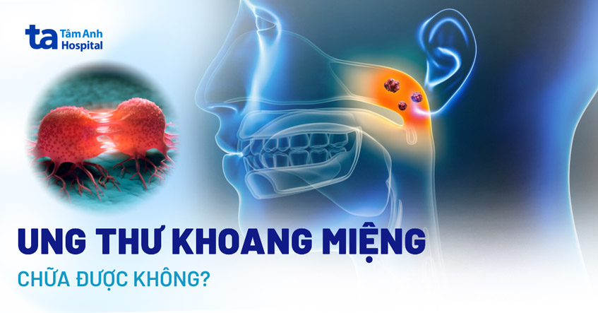 Ung thư khoang miệng có chữa được không? 6 cách điều trị hiện nay