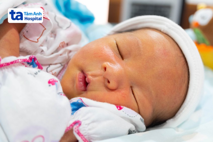 Vàng da sơ sinh khiến da, niêm mạc của trẻ vàng