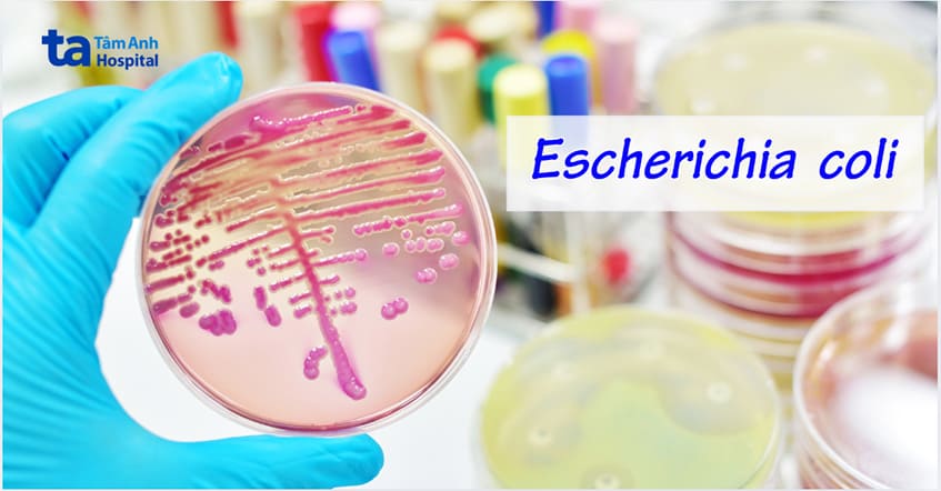 Vi khuẩn E.coli có khả năng phát triển kháng kháng sinh