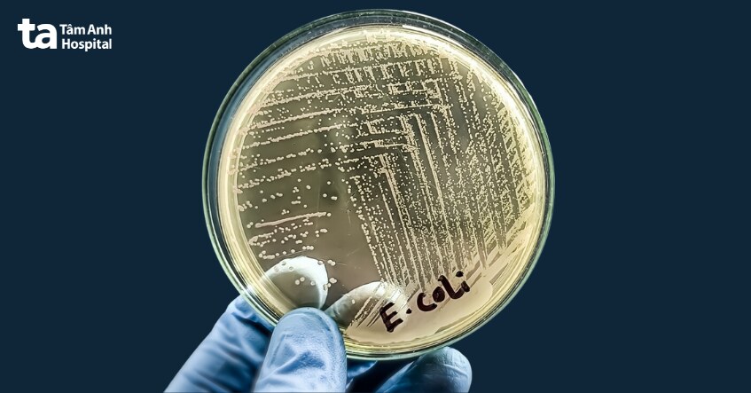 vi khuẩn e coli