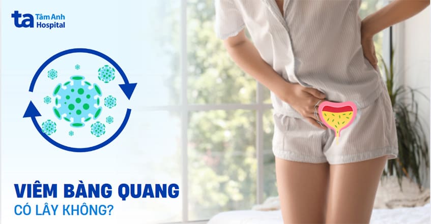 Viêm bàng quang có lây không? Lây qua đường nào?
