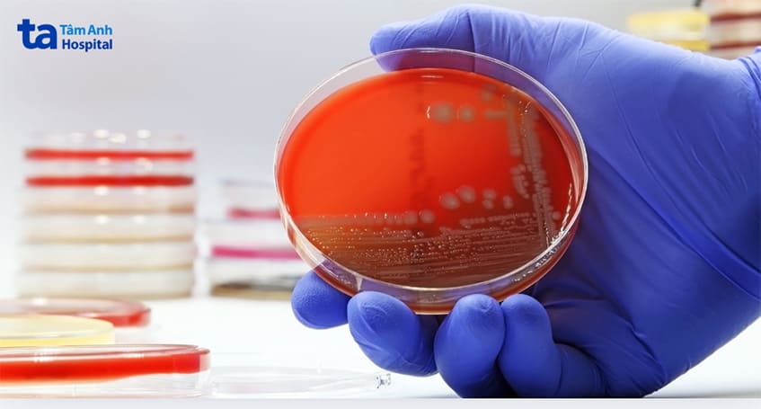 Viêm bàng quang nhẹ do E.coli gây ra có thể tự khỏi