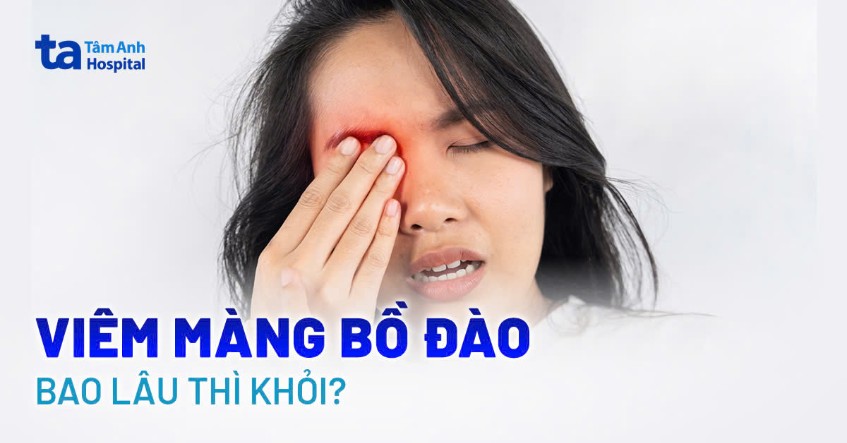 Viêm màng bồ đào bao lâu thì khỏi? Các yếu tố ảnh hưởng phục hồi