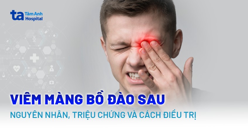 viêm màng bồ đào sau