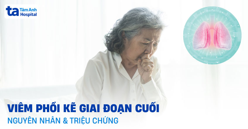 Viêm phổi kẽ giai đoạn cuối: Nguyên nhân và triệu chứng bệnh