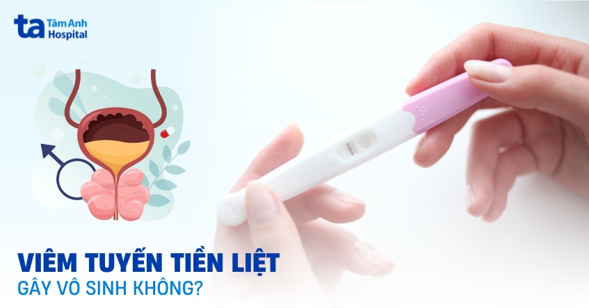 Viêm tuyến tiền liệt có gây vô sinh không? Có con được không?