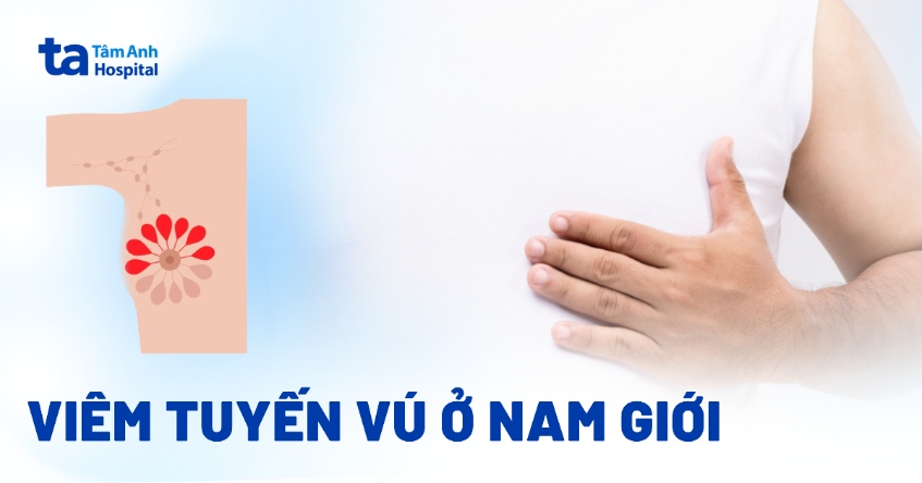 viêm tuyến vú ở nam giới
