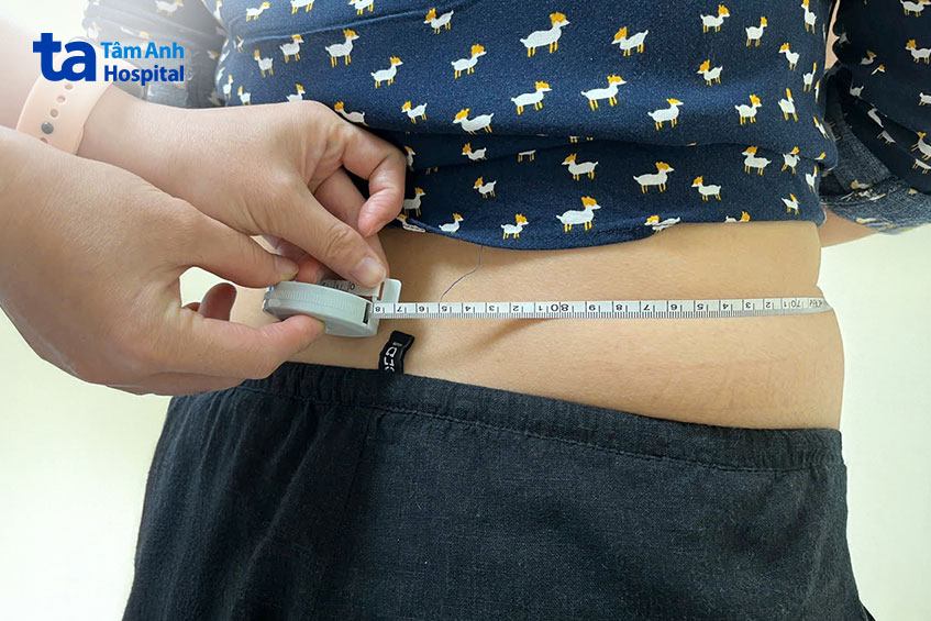 Vòng eo chị U. sau khi giảm cân 1 tháng