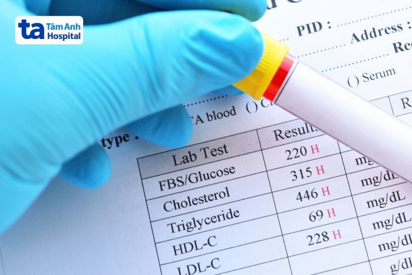 Xét nghiệm máu là phương pháp phổ biến để chẩn đoán tình trạng cholesterol cao