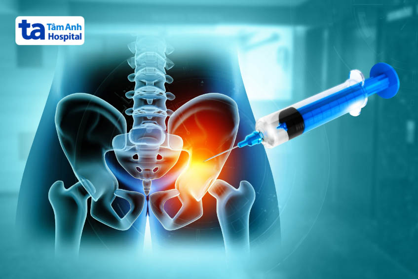 Xét nghiệm nguyên nhân bị đau khớp háng