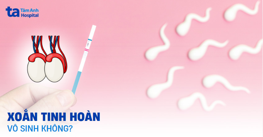 Xoắn tinh hoàn có gây vô sinh không? Có con được không?