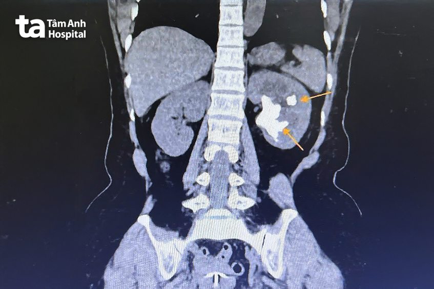 ảnh chụp ct của bệnh nhân