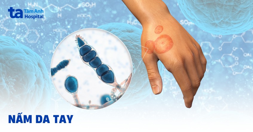 B£n sao cça Thumb template - Thumb m«u 1 dòng tiêu Á