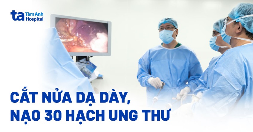 Cắt bỏ nửa dạ dày, nạo 30 hạch điều trị ung thư