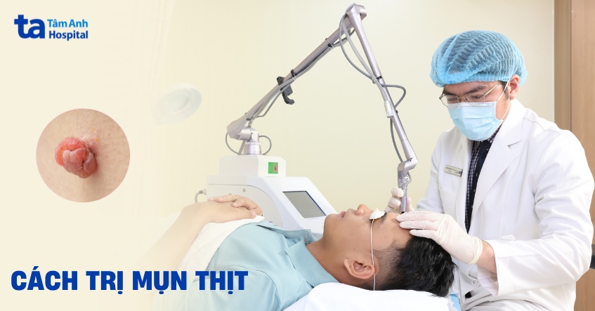 4 cách trị mụn thịt dư trên mặt an toàn hiệu quả được khuyến nghị