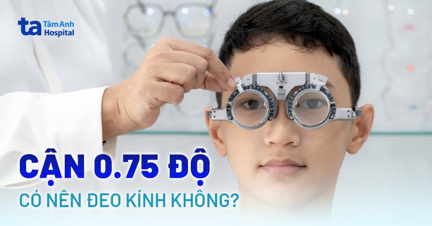 Mắt cận 0.75 độ có nên đeo kính không? Tần suất và một số lưu ý