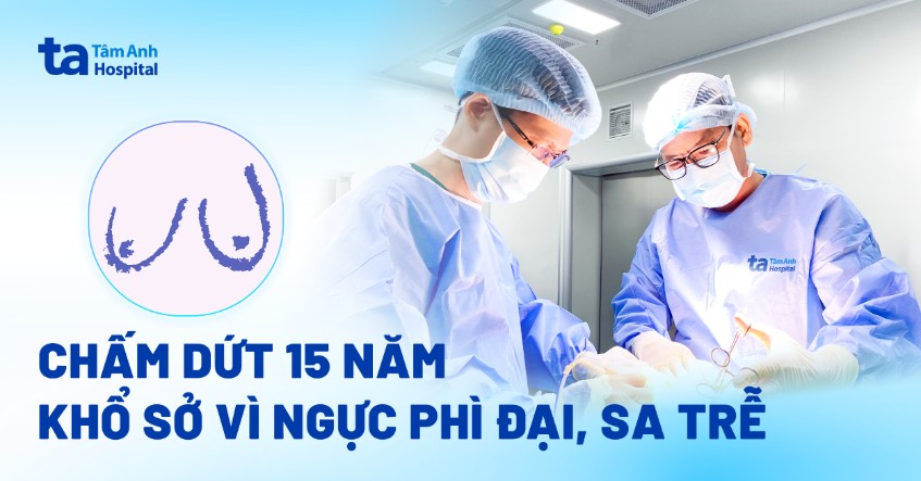 Chấm dứt 15 năm khổ sở vì ngực sa trễ