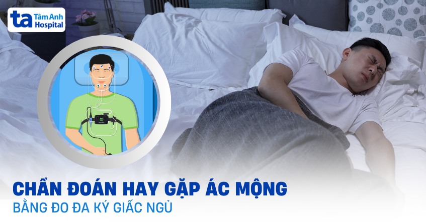 Chẩn đoán hay gặp ác mộng bằng đo đa ký giấc ngủ như thế nào?