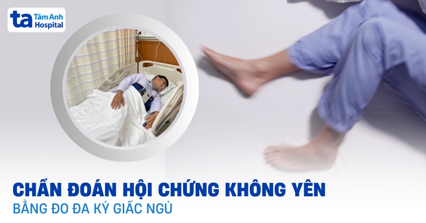 Chẩn đoán hội chứng chân không yên bằng đo đa ký giấc ngủ