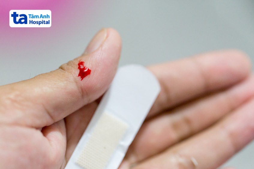 chọc hút nang gan siêu âm