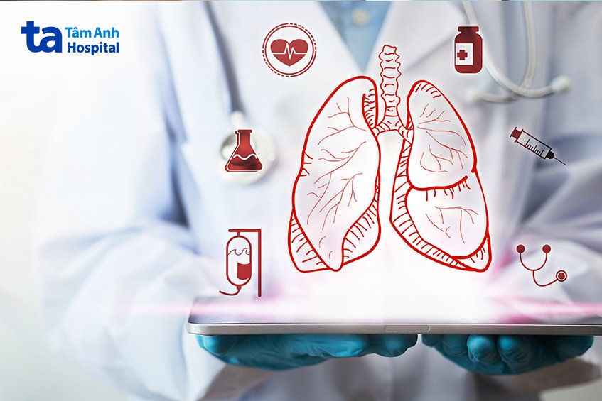 chọn phương pháp điều trị tràn khí màng phổi phù hợp