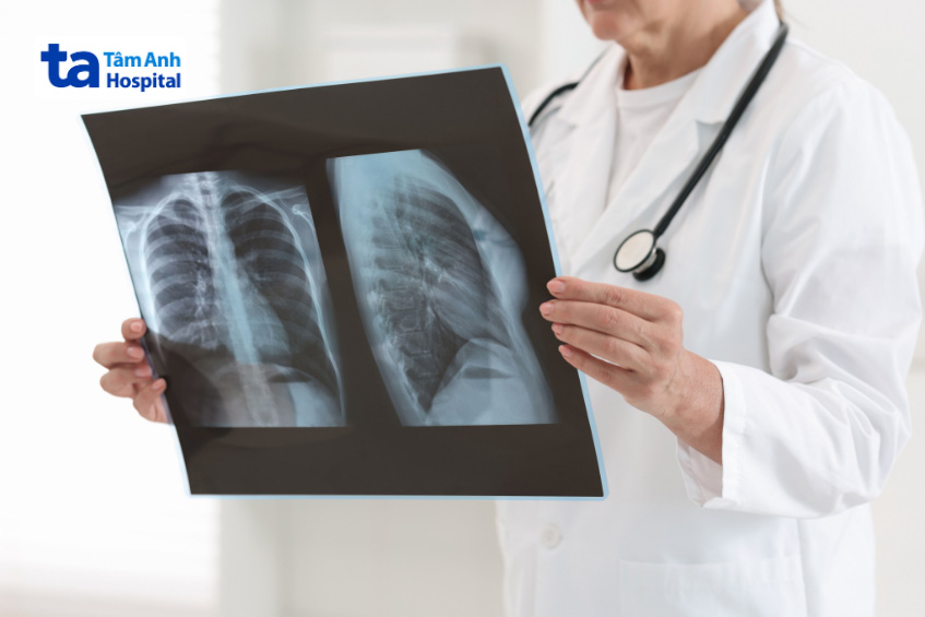 Chụp X Quang ngực giúp đánh giá các tình trạng bệnh lý liên quan đến tim và hệ hô hấp