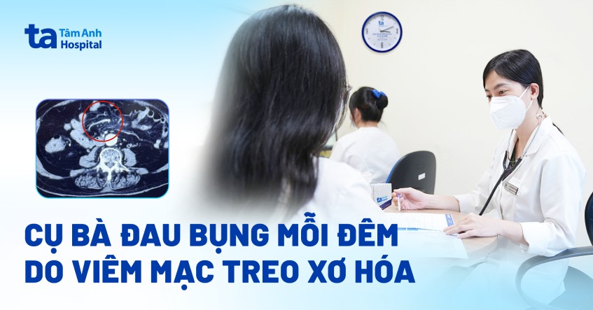 Cụ bà đau bụng mỗi đêm do viêm mạc treo xơ hóa