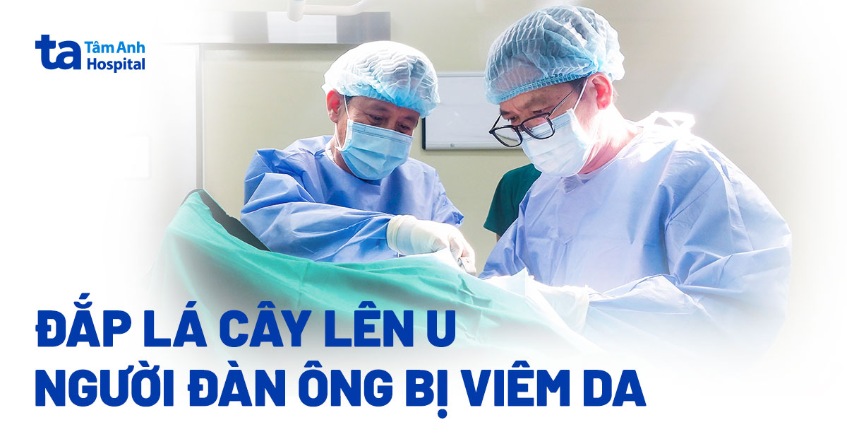 Đắp lá cây lên bướu mỡ, người đàn ông bị viêm da