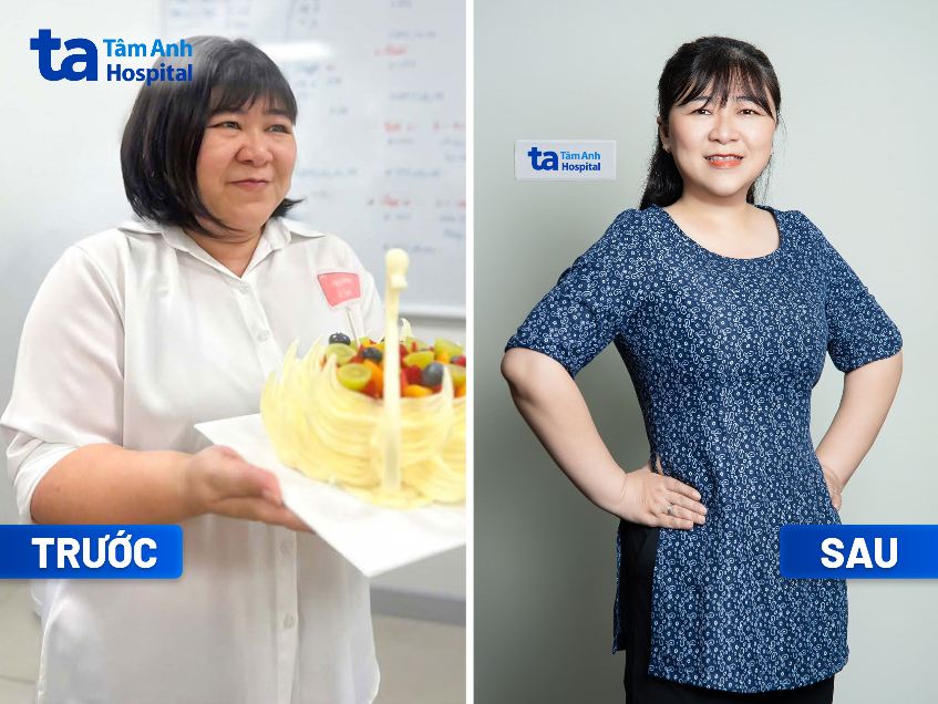 dấu hiệu giảm béo thành công