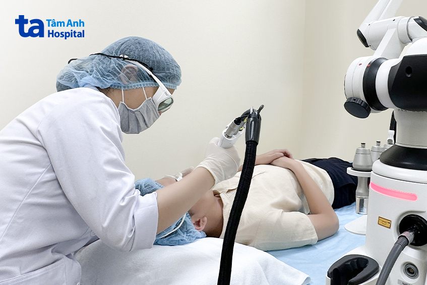 điều trị giãn mao mạch bằng laser 4d