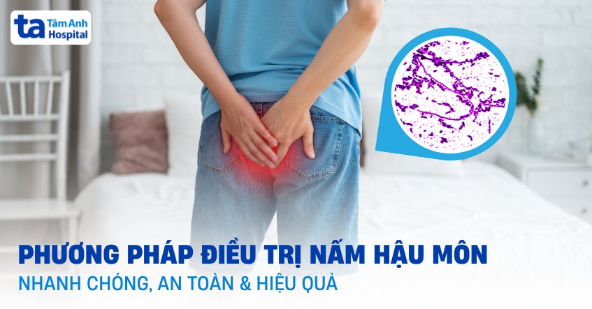 Phương pháp điều trị nấm hậu môn an toàn, hiệu quả mất bao lâu?