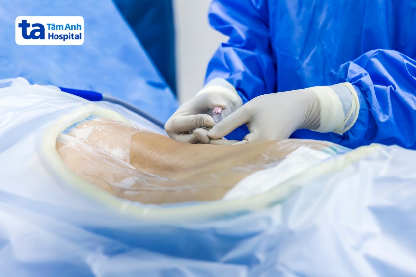 điều trị rò dịch não tủy tránh biến chứng