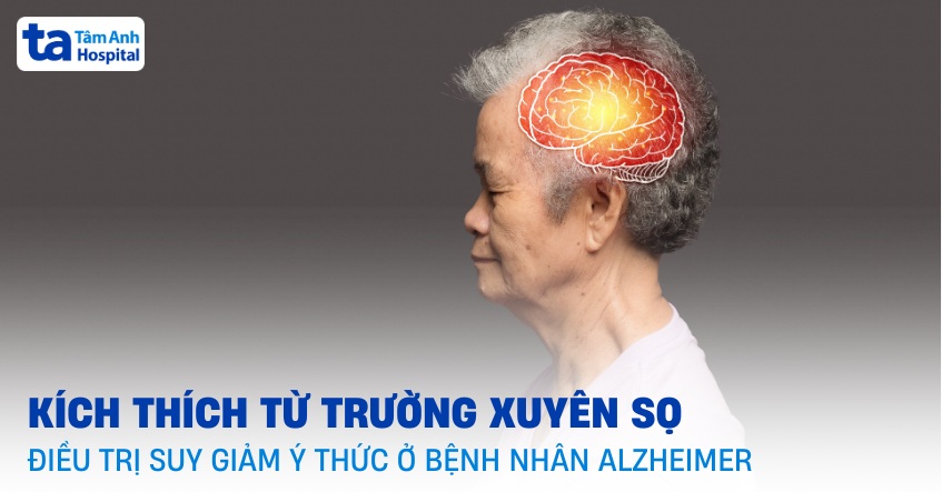 điều trị suy giảm ý thức ở bệnh nhân alzheimer bằng tms