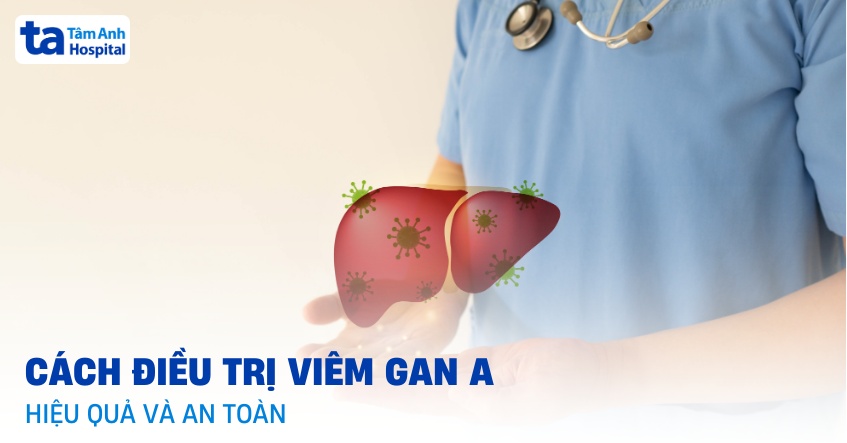 3 cách điều trị viêm gan A như thế nào để hiệu quả và an toàn?