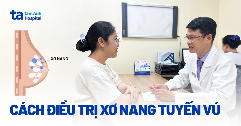 5 cách điều trị xơ nang tuyến vú và hướng phòng ngừa hiệu quả