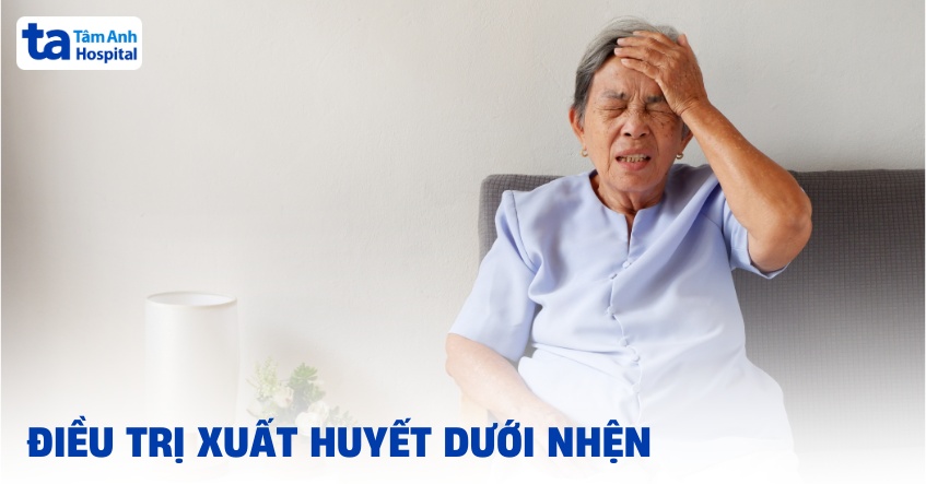 3 phương pháp điều trị xuất huyết dưới nhện phổ biến hiện nay