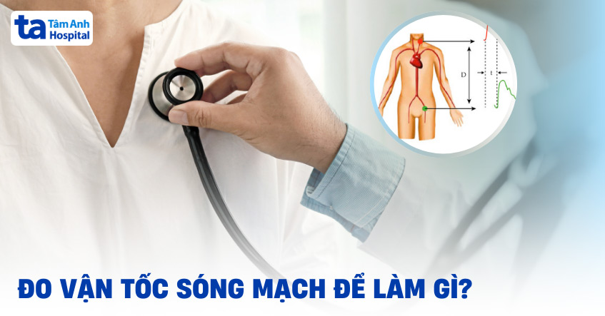 Đo vận tốc sóng mạch để làm gì? Chỉ định và vai trò ứng dụng