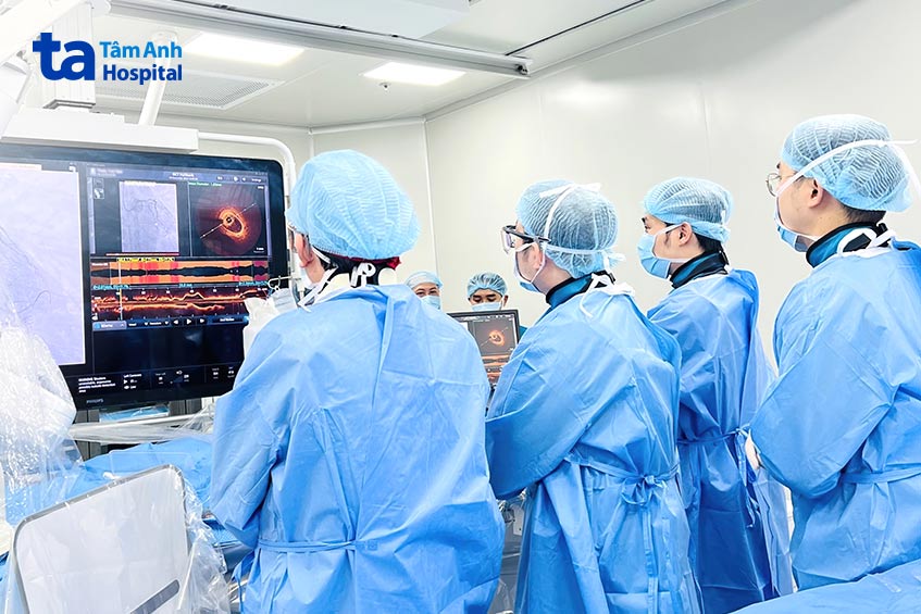 Giáo sư Nhân (ngoài cùng bên trái) cùng ê kíp sử dụng kỹ thuật OCT để chọn stent phù hợp tái thông mạch máu cho bệnh nhân