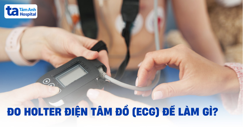 Đo Holter điện tâm đồ (ECG): Chỉ định, ưu điểm và quy trình