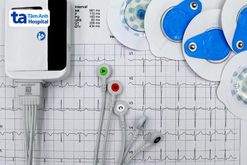 Holter điện tâm đồ giúp theo dõi, phát hiện các rối loạn nhịp tim không thường xuyên