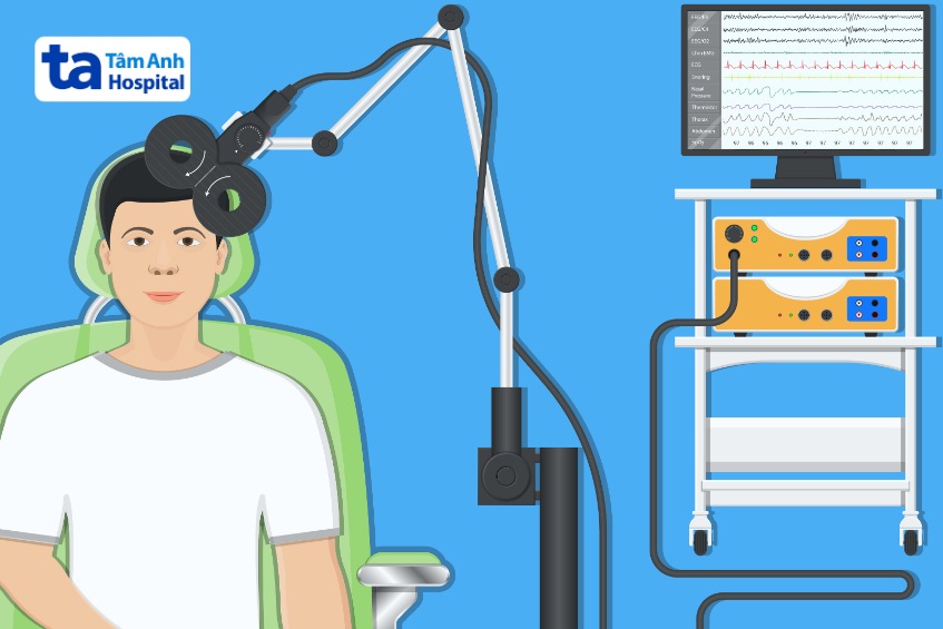 kích thích từ trường xuyên sọ có thể dùng hỗ trợ cai rượu