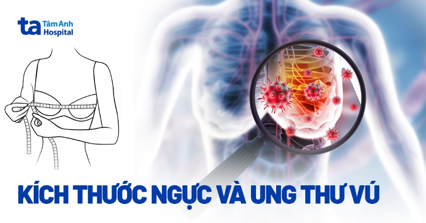 Kích thước ngực và ung thư vú: Mối liên hệ và nguy cơ ung thư vú