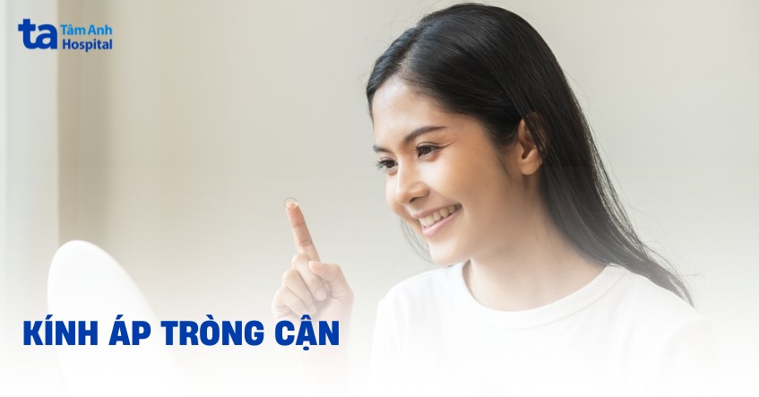 Kính áp tròng cận thị là gì? Phân loại, ưu nhược điểm, sử dụng