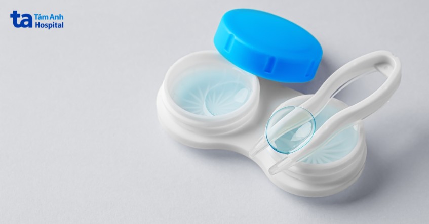 kính áp tròng là giải pháp cho loạn thị